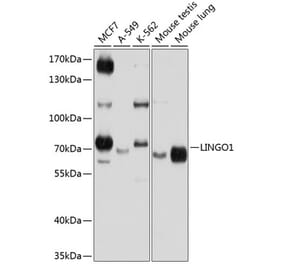 Western Blot - Anti-Lingo1 Antibody (A12360) - Antibodies.com