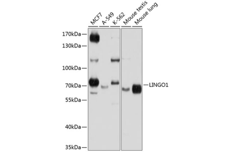 Western Blot - Anti-Lingo1 Antibody (A12360) - Antibodies.com