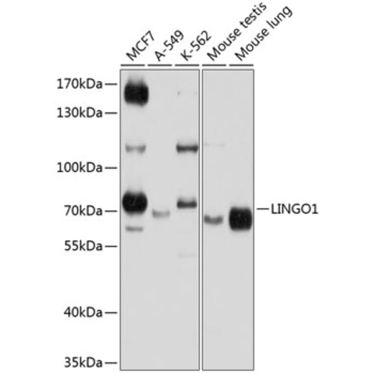 Western Blot - Anti-Lingo1 Antibody (A12360) - Antibodies.com