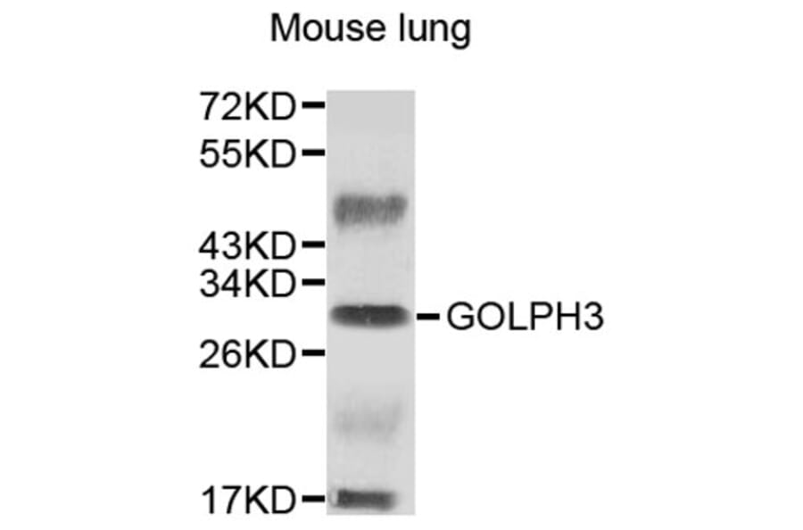 Western Blot - Anti-GOLPH3 Antibody (A9371) - Antibodies.com