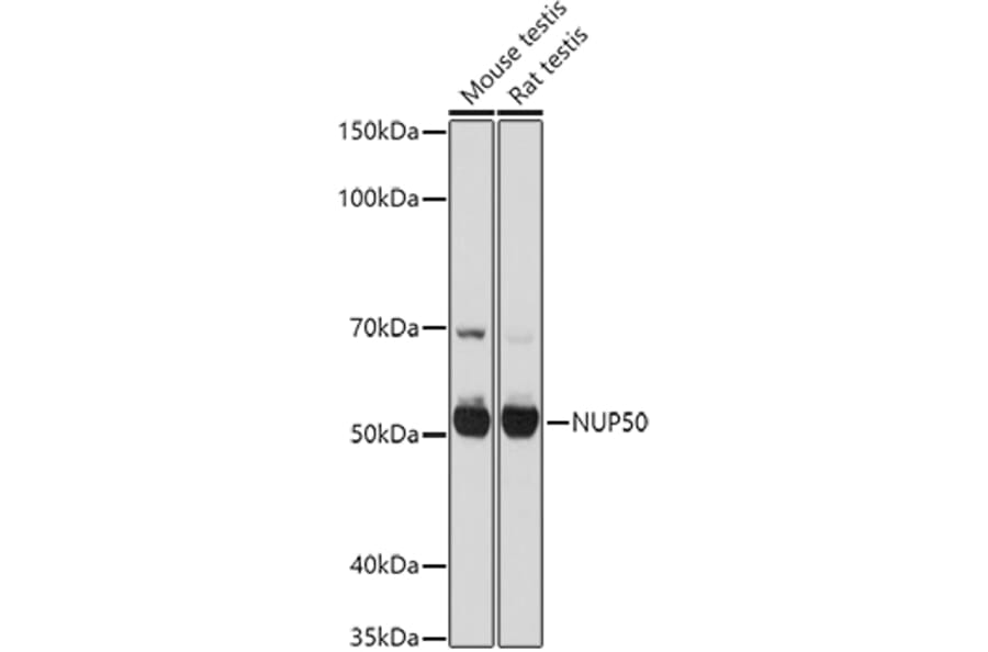 Western Blot - Anti-NUP50 Antibody (A12363) - Antibodies.com