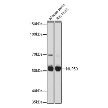 Western Blot - Anti-NUP50 Antibody (A12363) - Antibodies.com