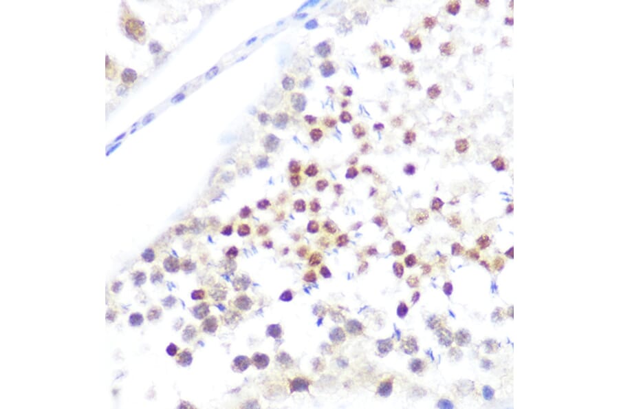 Immunohistochemistry - Anti-NUP50 Antibody (A12363) - Antibodies.com