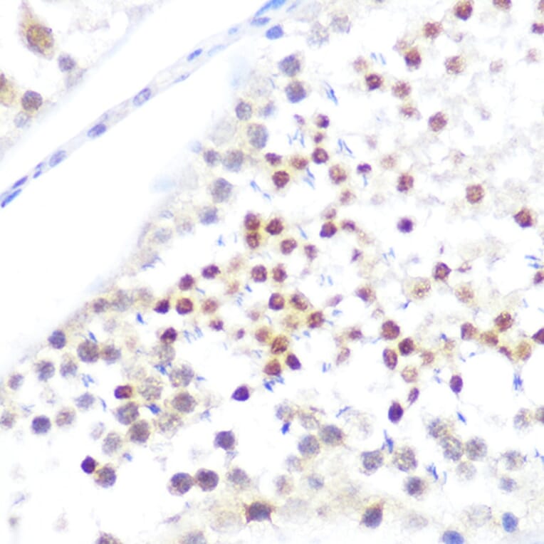 Immunohistochemistry - Anti-NUP50 Antibody (A12363) - Antibodies.com