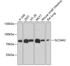 Western Blot - Anti-SLC34A2 Antibody (A12364) - Antibodies.com