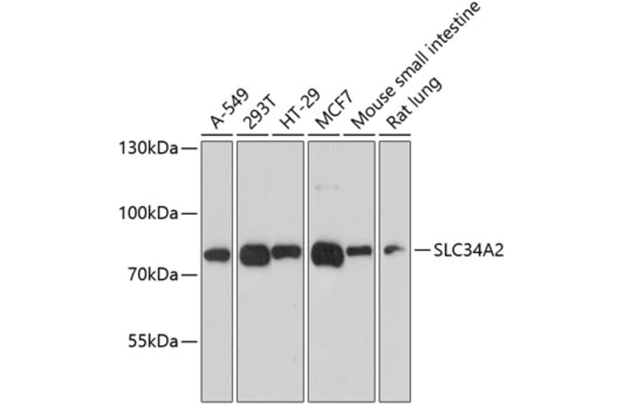 Western Blot - Anti-SLC34A2 Antibody (A12364) - Antibodies.com