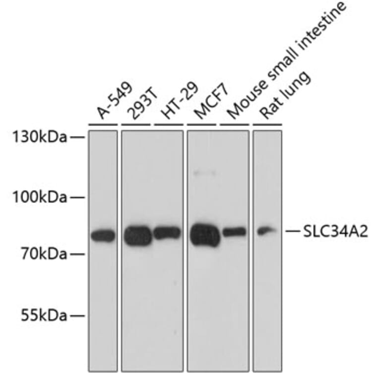Western Blot - Anti-SLC34A2 Antibody (A12364) - Antibodies.com