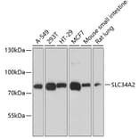 Western Blot - Anti-SLC34A2 Antibody (A12364) - Antibodies.com