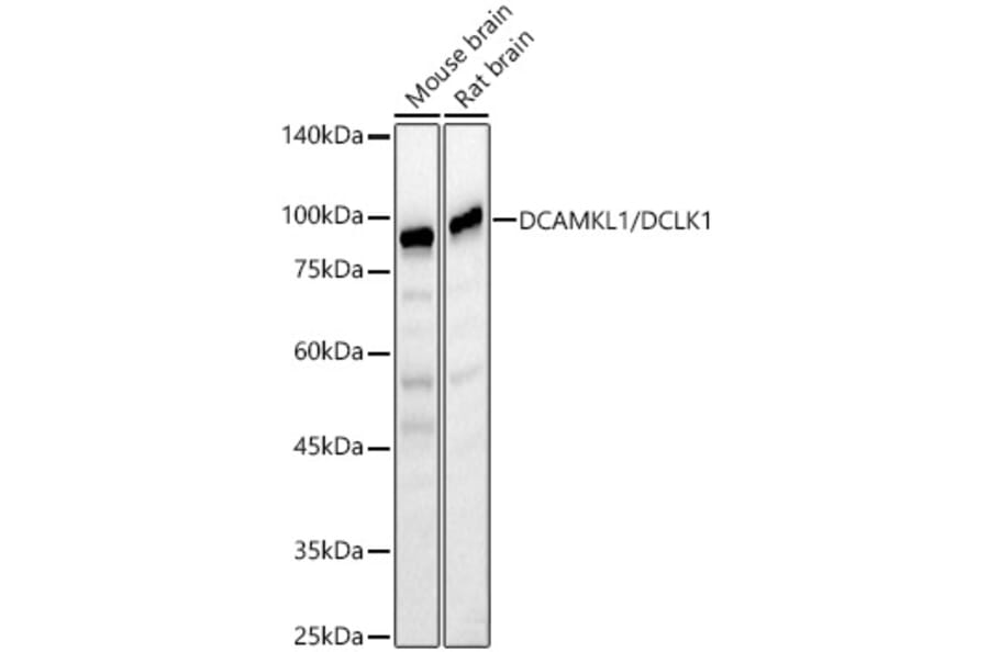 Western Blot - Anti-DCAMKL1 Antibody (A12365) - Antibodies.com
