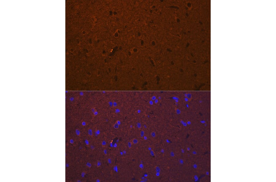 Immunofluorescence - Anti-DCAMKL1 Antibody (A12365) - Antibodies.com