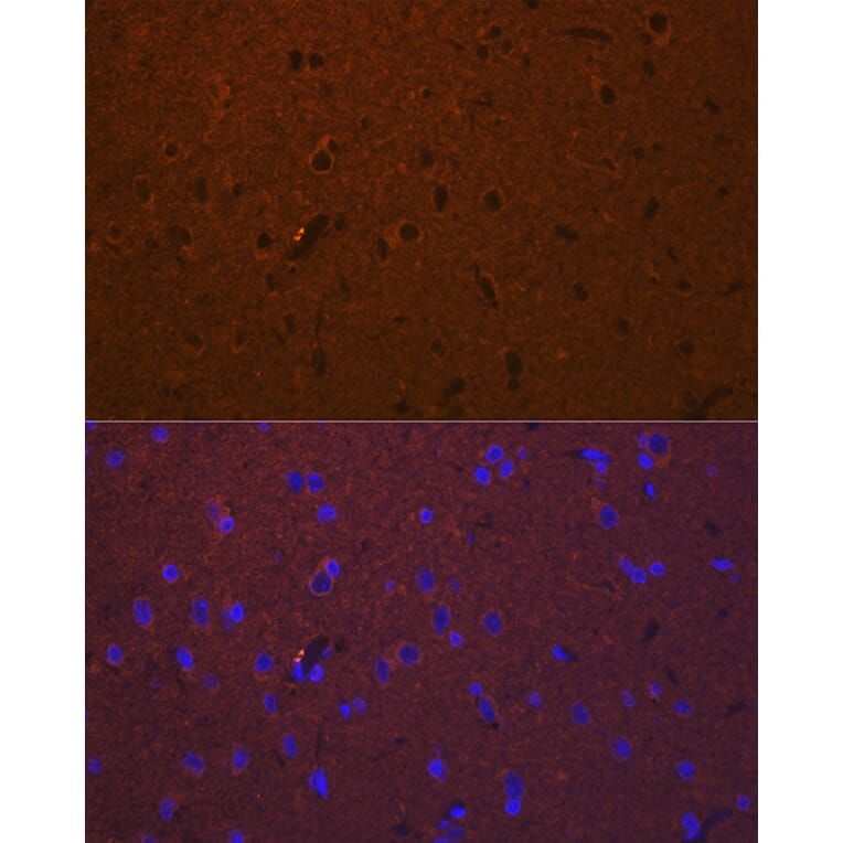 Immunofluorescence - Anti-DCAMKL1 Antibody (A12365) - Antibodies.com