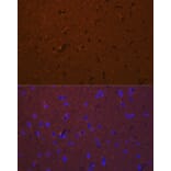 Immunofluorescence - Anti-DCAMKL1 Antibody (A12365) - Antibodies.com