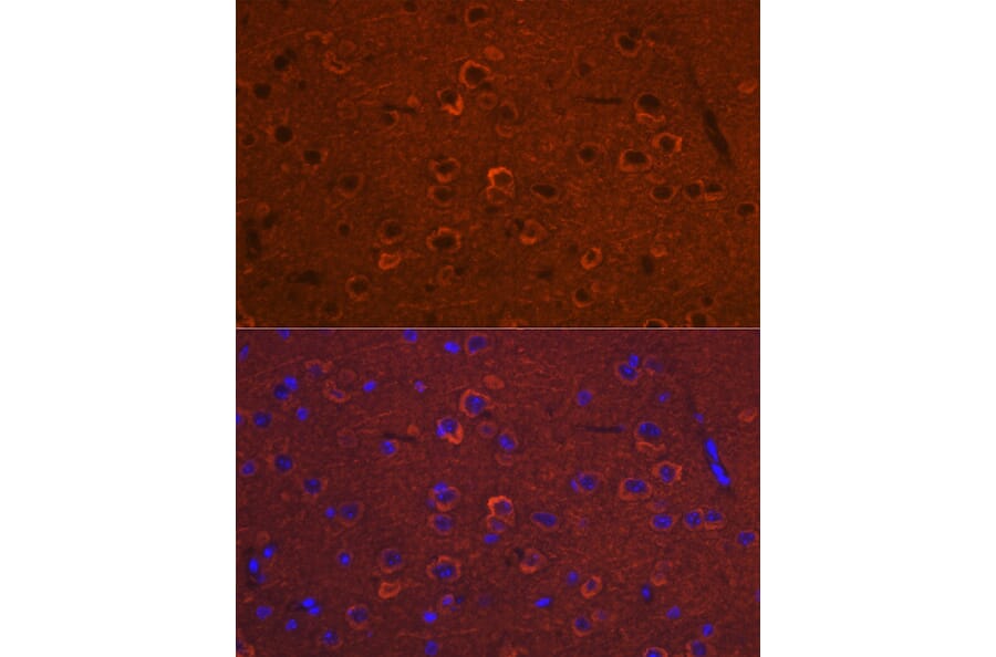 Immunofluorescence - Anti-DCAMKL1 Antibody (A12365) - Antibodies.com