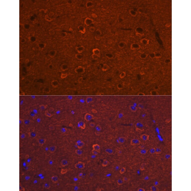 Immunofluorescence - Anti-DCAMKL1 Antibody (A12365) - Antibodies.com
