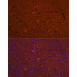 Immunofluorescence - Anti-DCAMKL1 Antibody (A12365) - Antibodies.com