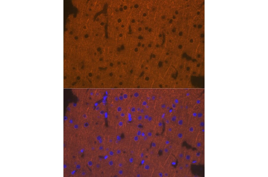 Immunofluorescence - Anti-DCAMKL1 Antibody (A12365) - Antibodies.com