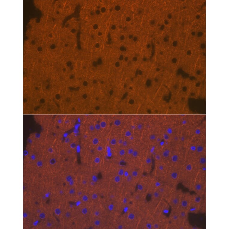 Immunofluorescence - Anti-DCAMKL1 Antibody (A12365) - Antibodies.com