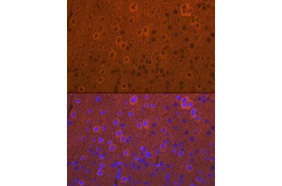 Immunofluorescence - Anti-DCAMKL1 Antibody (A12365) - Antibodies.com