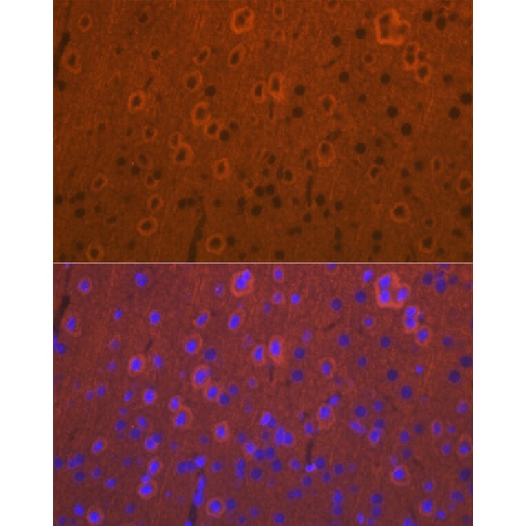 Immunofluorescence - Anti-DCAMKL1 Antibody (A12365) - Antibodies.com