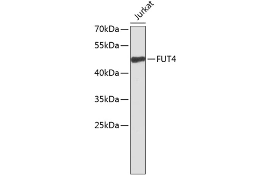 Western Blot - Anti-FUT4 Antibody (A9504) - Antibodies.com