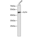 Western Blot - Anti-FUT4 Antibody (A9504) - Antibodies.com