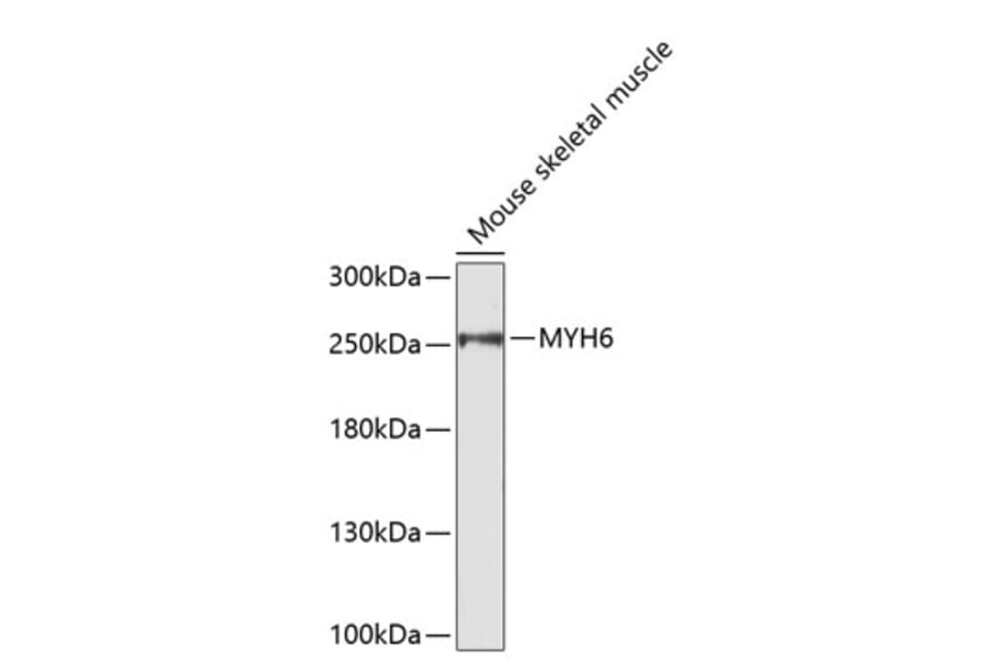 Western Blot - Anti-MYH6 Antibody (A9516) - Antibodies.com