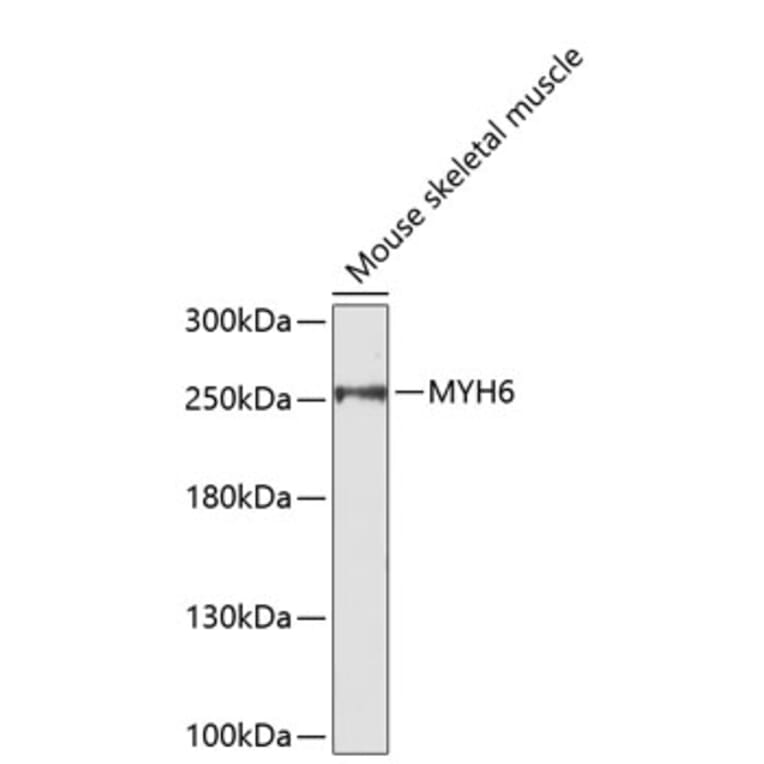 Western Blot - Anti-MYH6 Antibody (A9516) - Antibodies.com