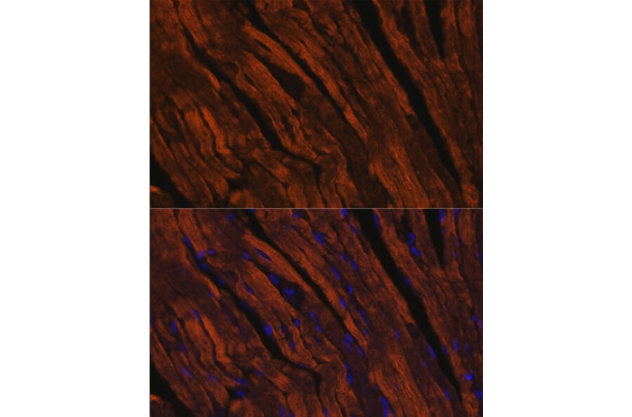 Immunofluorescence - Anti-MYH6 Antibody (A9516) - Antibodies.com