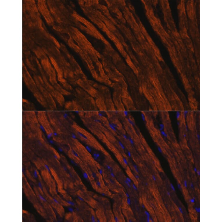 Immunofluorescence - Anti-MYH6 Antibody (A9516) - Antibodies.com