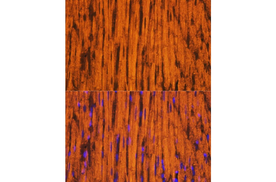 Immunofluorescence - Anti-MYH6 Antibody (A9516) - Antibodies.com