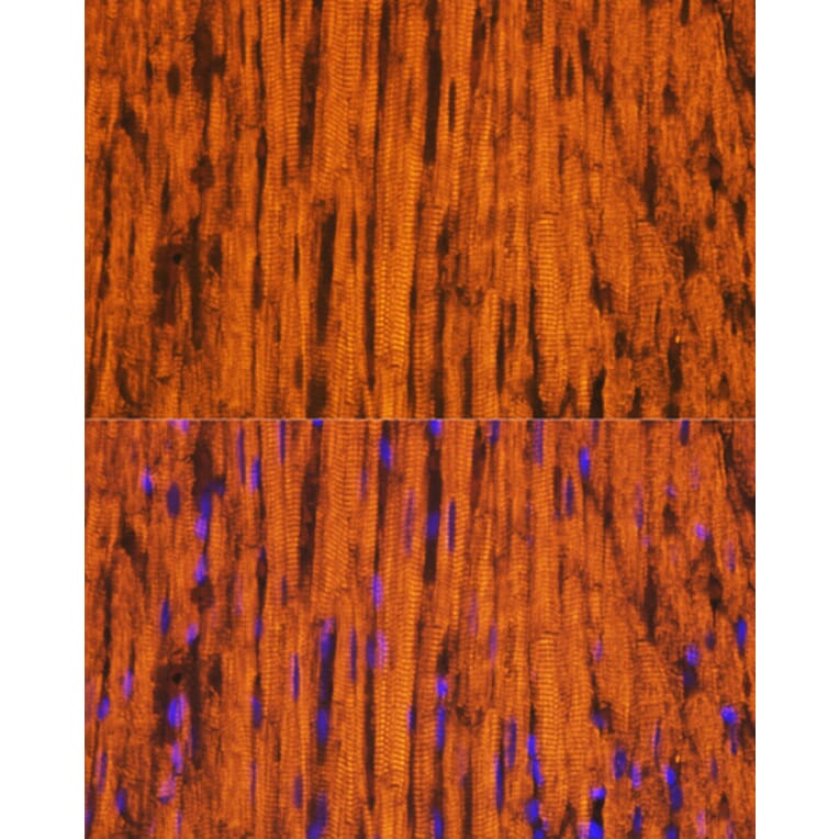 Immunofluorescence - Anti-MYH6 Antibody (A9516) - Antibodies.com