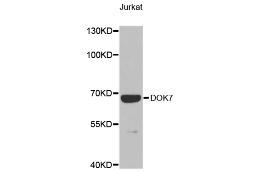 Western Blot - Anti-DOK7 Antibody (A9537) - Antibodies.com