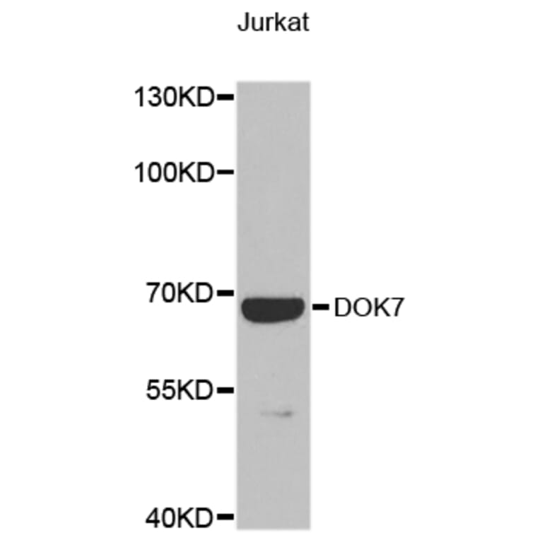 Western Blot - Anti-DOK7 Antibody (A9537) - Antibodies.com