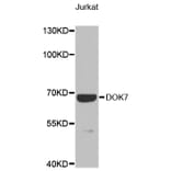 Western Blot - Anti-DOK7 Antibody (A9537) - Antibodies.com