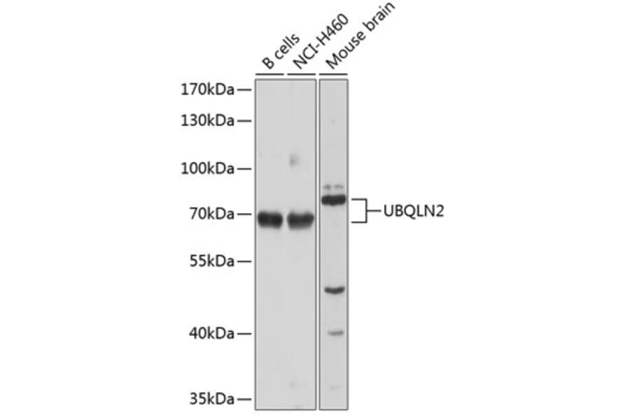 Western Blot - Anti-UBQLN2 Antibody (A12376) - Antibodies.com