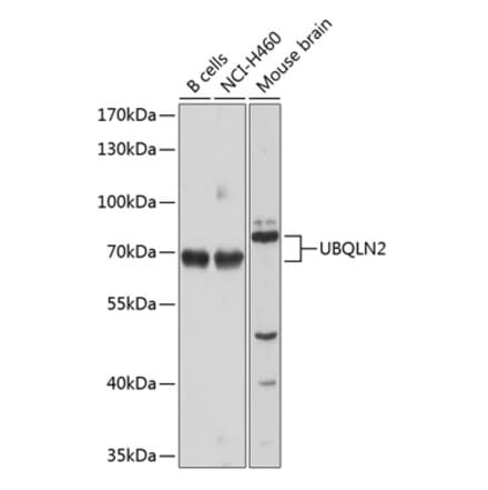 Western Blot - Anti-UBQLN2 Antibody (A12376) - Antibodies.com