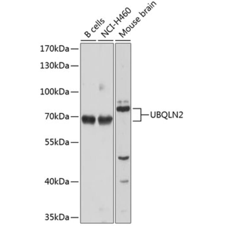 Western Blot - Anti-UBQLN2 Antibody (A12376) - Antibodies.com