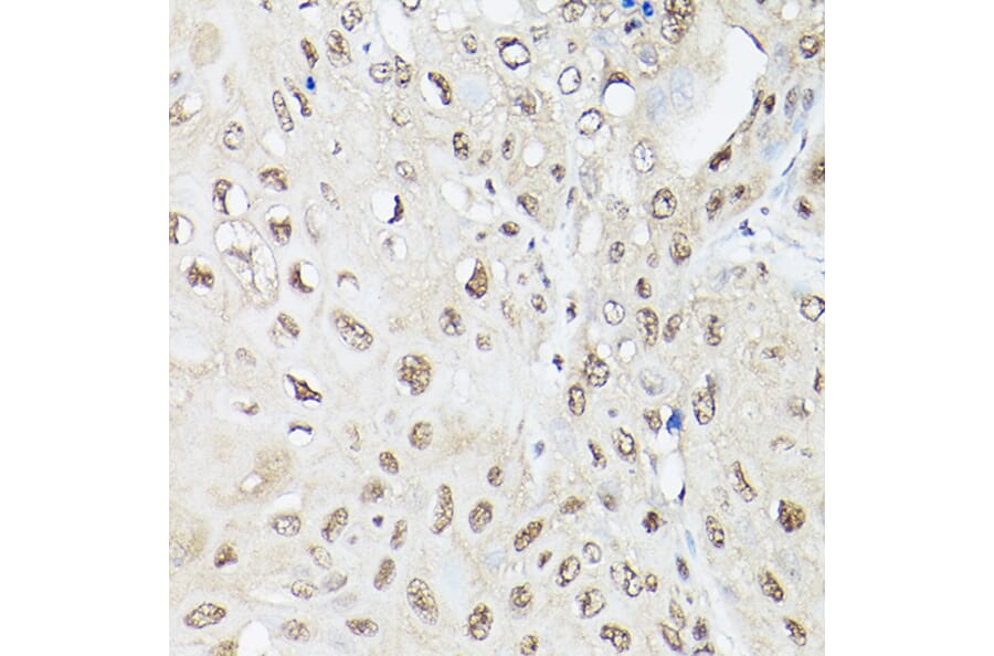 Immunohistochemistry - Anti-UBQLN2 Antibody (A12376) - Antibodies.com