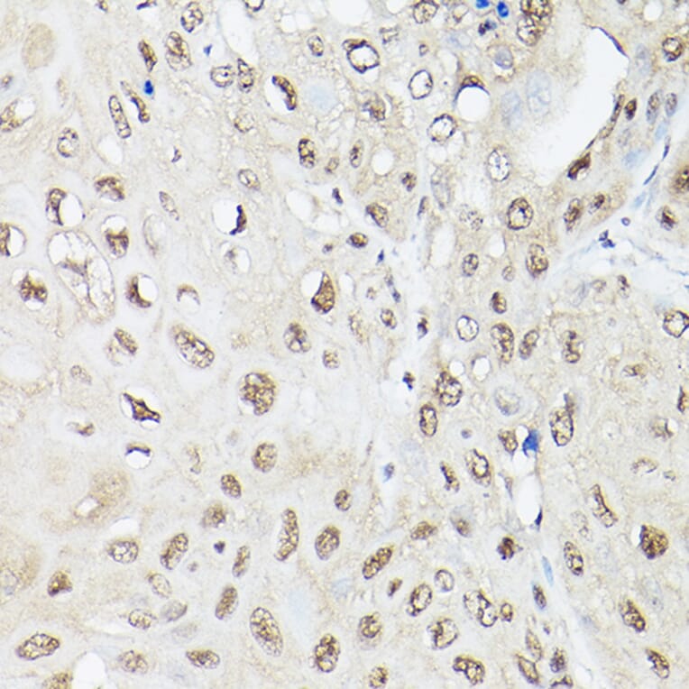 Immunohistochemistry - Anti-UBQLN2 Antibody (A12376) - Antibodies.com