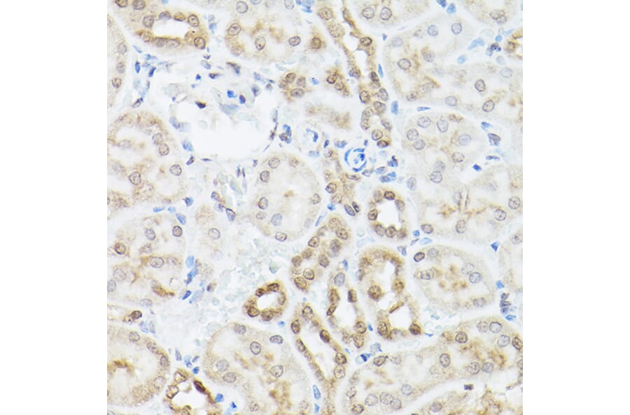 Immunohistochemistry - Anti-UBQLN2 Antibody (A12376) - Antibodies.com