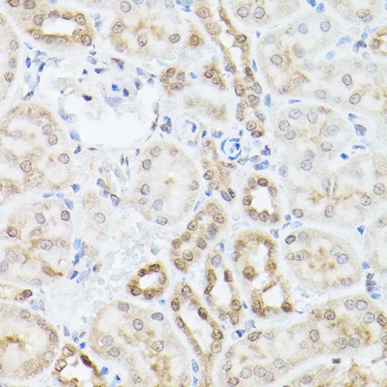 Immunohistochemistry - Anti-UBQLN2 Antibody (A12376) - Antibodies.com