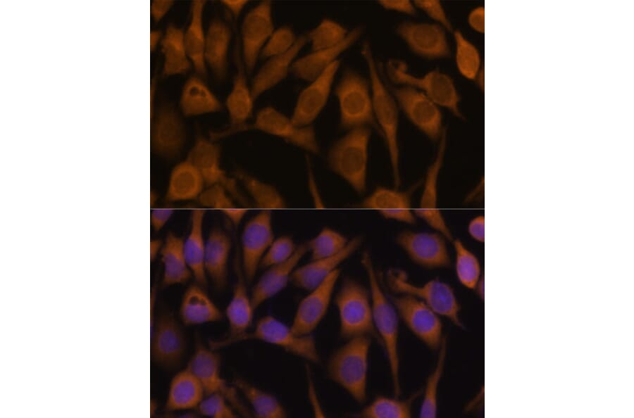 Immunofluorescence - Anti-UBQLN2 Antibody (A12376) - Antibodies.com