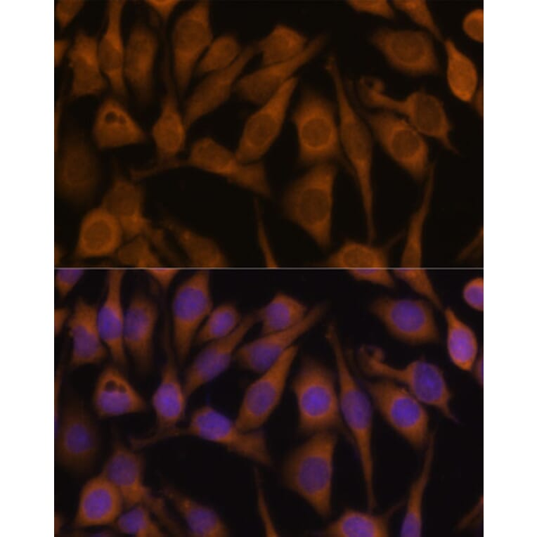 Immunofluorescence - Anti-UBQLN2 Antibody (A12376) - Antibodies.com