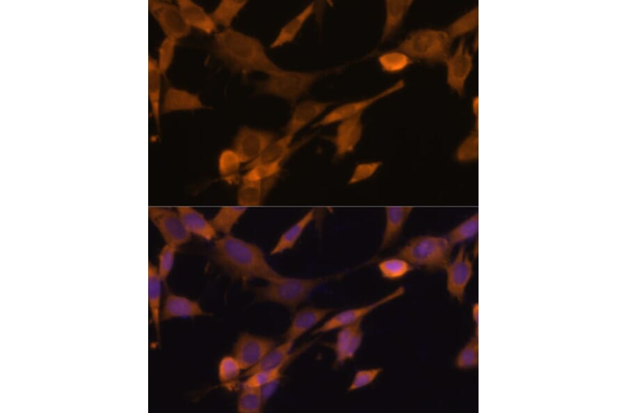 Immunofluorescence - Anti-UBQLN2 Antibody (A12376) - Antibodies.com