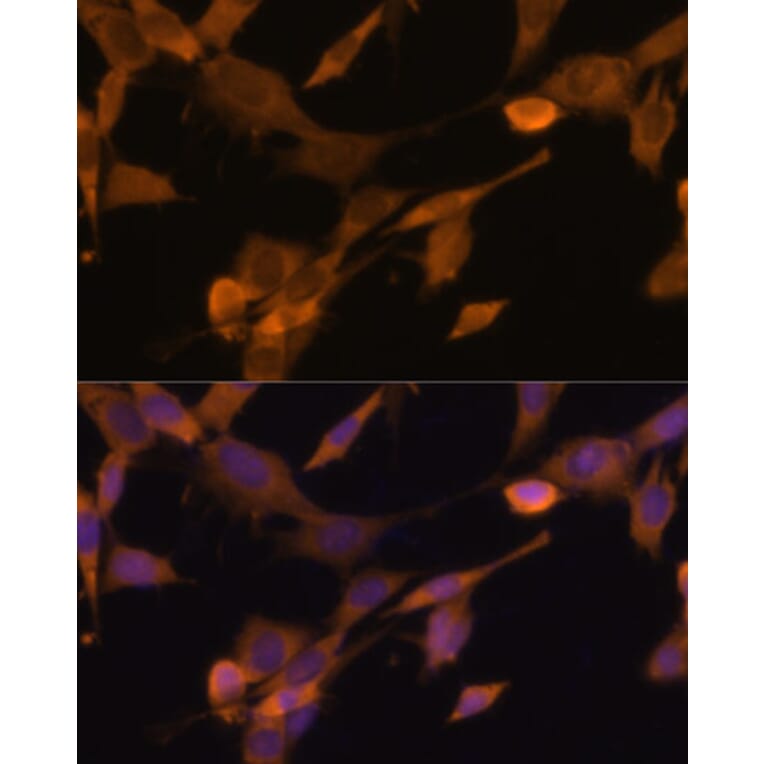 Immunofluorescence - Anti-UBQLN2 Antibody (A12376) - Antibodies.com