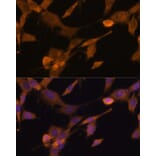 Immunofluorescence - Anti-UBQLN2 Antibody (A12376) - Antibodies.com