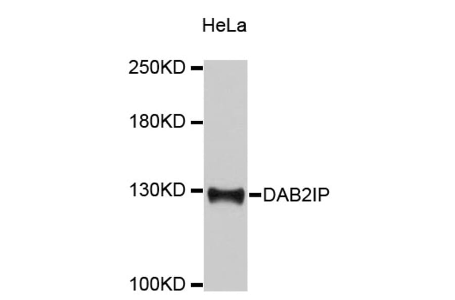 Western Blot - Anti-DAB2IP Antibody (A9572) - Antibodies.com