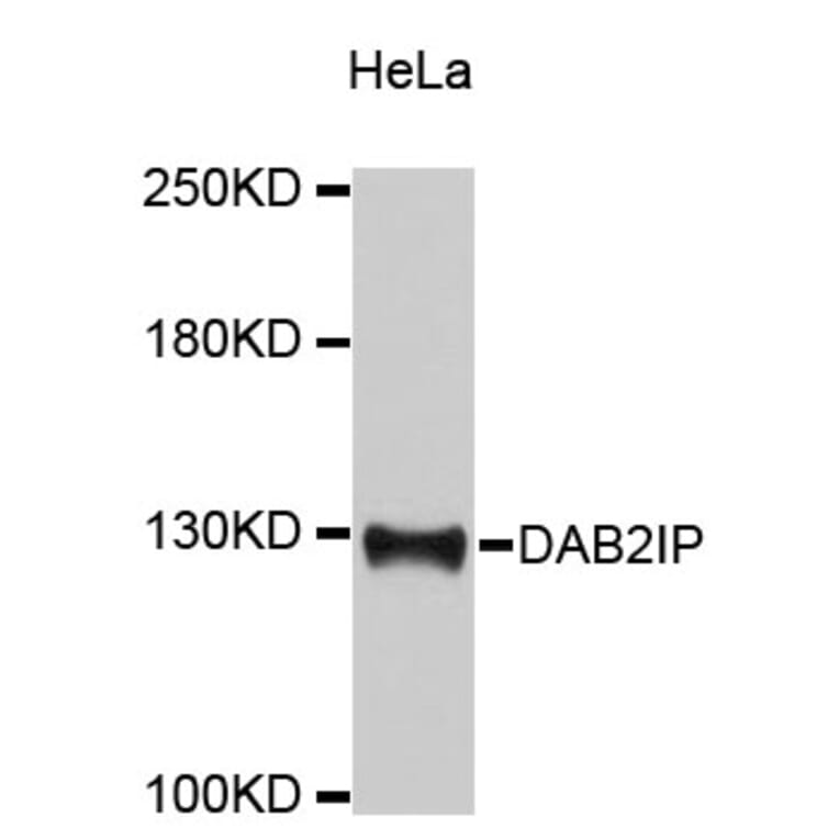 Western Blot - Anti-DAB2IP Antibody (A9572) - Antibodies.com
