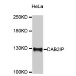 Western Blot - Anti-DAB2IP Antibody (A9572) - Antibodies.com