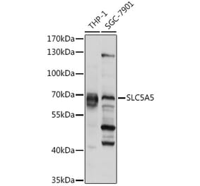 Western Blot - Anti-Sodium Iodide Symporter Antibody (A12380) - Antibodies.com